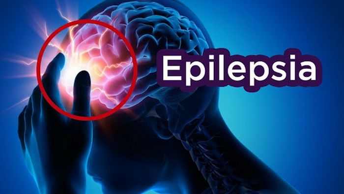  Šiandien minima Europos Epilepsijos diena