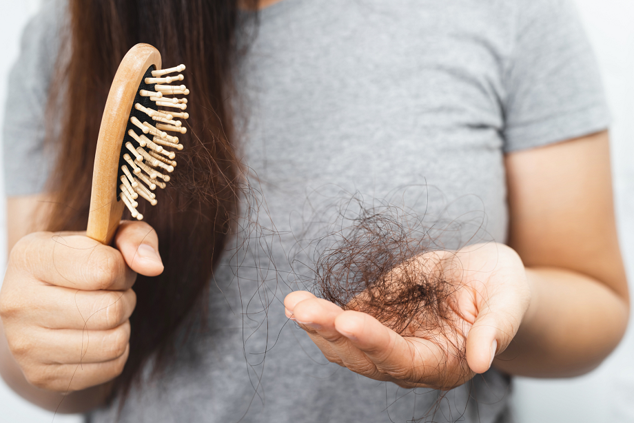  Plaukų slinkimas: liga, kuriai gydyti galimybių yra